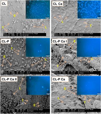 Hemocompatibility of cellulose phosphate aerogel membranes with potential use in bone tissue engineering